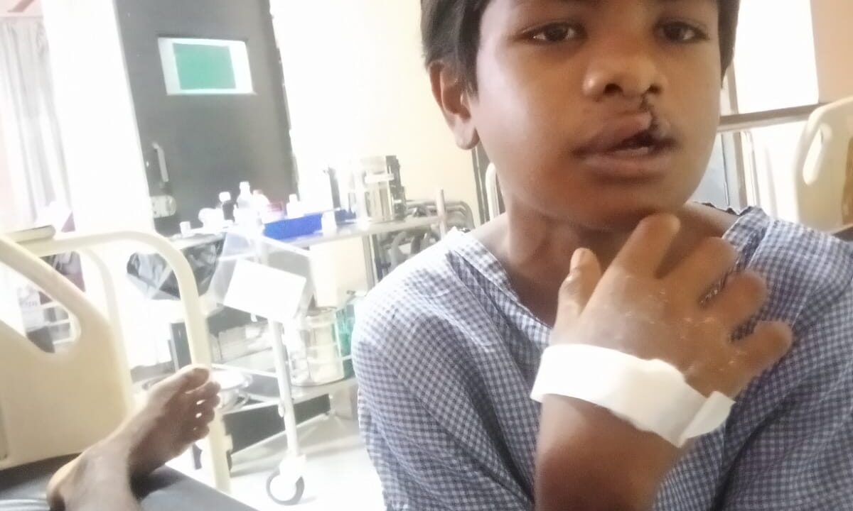 गरीबी बनी इलाज में बाधा, सरकार बनी सहारा: ‘चिरायु’ योजना से 15 वर्षीय माड़कम हुंगा को मिला नया जीवन